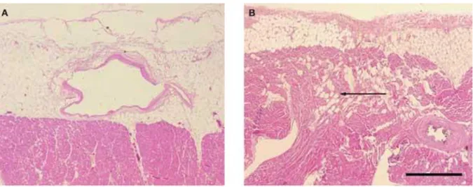 Figure 1: Images histologiques démontrant la continuité anatomique entre le tissu adipeux  épicardique et le myocarde ventriculaire gauche (A)  et ventriculaire droit (B)