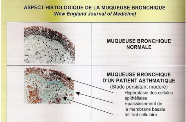 Figure 6: Aspect histologique de la muqueuse bronchique (3) 