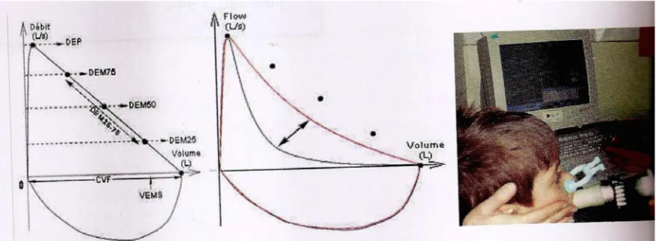 Figure 8: Courbe débit volume lors d'un test de réversibilité (5) 