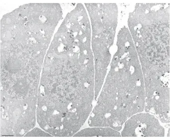 Fig. 3. Evidence for the accumulation of metal particles in root tissues of plants grown on mine tailings (b 1 , b 2 , c and d) compared to control plants (a)