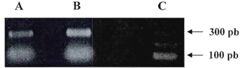 Figure  9:  Analyse  de  la  RT-PCR  de  l'ADNe  de  l'apoC-I  par  électrophorèse  sur  gel  d'agarose à  1%
