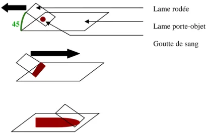 Figure 4 : Réalisation du frottis sanguin 