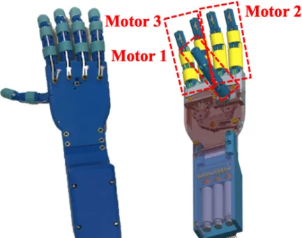 Figure 44 : Design final de la prothèse mécatronique.	