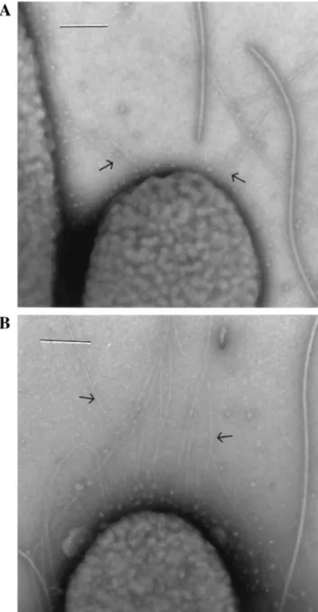 FIG. 6. Transmission electron micrographs of L (A) and S2 (B) variants. Cells were grown overnight on LB agar plates, transferred onto Formvar-coated copper grids, and stained with phosphotungstic acid