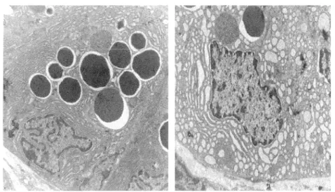 Figure 4. L'autophagie dans la différenciation des cellules de Paneth 