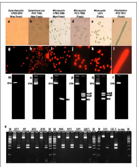 Figure 9.  Méthodes microscopiques conventionnelles et méthodes moléculaires utilisées pour  la détection et l’identification de souches de cyanobactéries toxiques et non toxiques