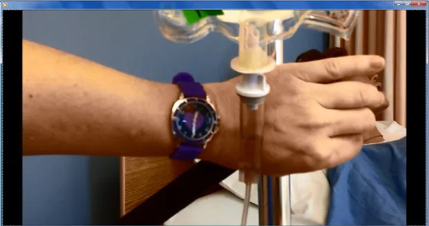 Figure 11 Extrait de la vidéo du calcul du débit de perfusion en gouttes par minute 