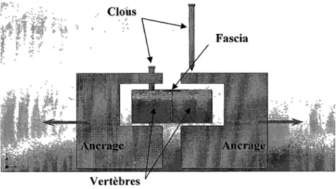 Figure 2.13 : Montage de l'échantillon de fascia dont les vertèbres sont fixées aux  ancrages par des clous