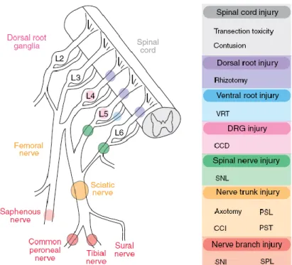 Figure 11 : Représentation des différents types de lésion de nerfs utilisés comme modèles  de douleur neuropathique (Decosterd and Derta, 2008)