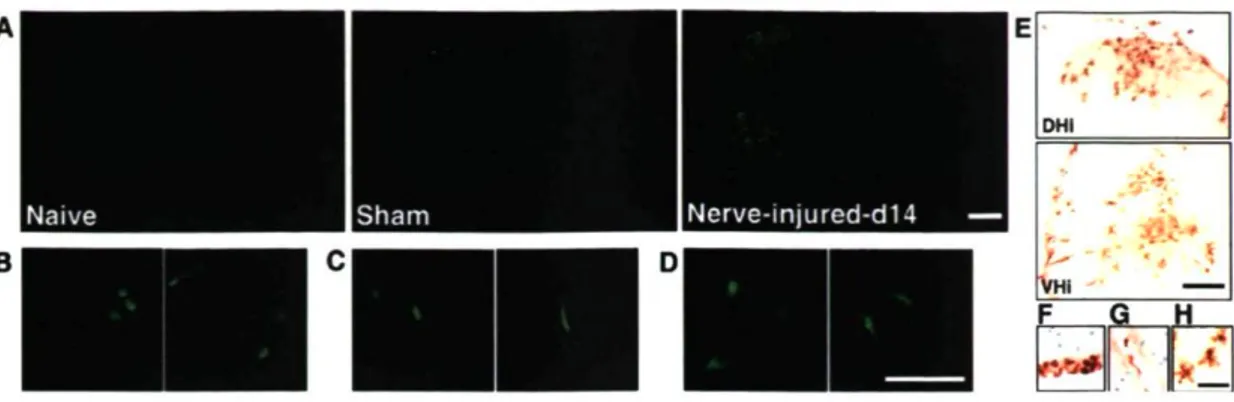Figure 1. Infiltration of bone marrow-derived cells into the spinal cord after sciatic  nerve injury