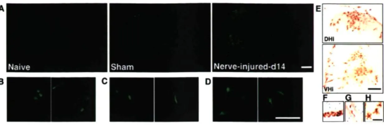 Figure 1. Infiltration of bone marrow-derived cells into the spinal cord after sciatic  nerve injury