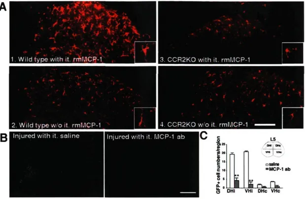Figure 6. Role of MCP-1 in stimulating resident microglial activation and peripheral  macrophage infiltration via its cognate receptor CCR2