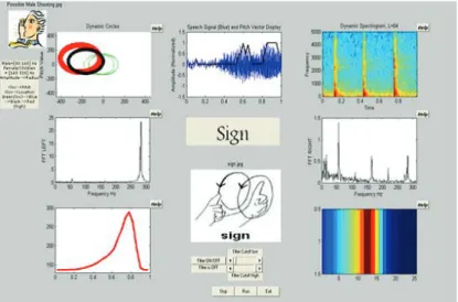 Figure 2.9 Interface de visualisation des sons pour malentendants [Azar et al., 2009]