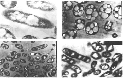 Figure 1     Granules de PHA observés par microscope électronique à balayage dans différentes cellules  bactériennes isolées de différents environnements 