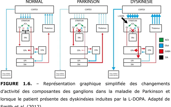 FIGURE  1.6.  –  Représentation  graphique  simplifiée  des  changements  d’activité  des  composantes  des  ganglions  dans  la  maladie  de  Parkinson  et  lorsque le patient présente des dyskinésies induites par la L-DOPA