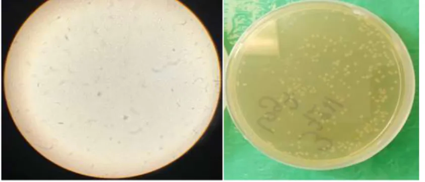 Figure 4: Bouillon fermenté après 72h de fermentation sans contamination microbienne et vue microscopique 