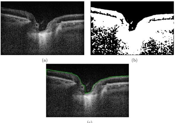 Figure 5.3c shows the segmented profile.