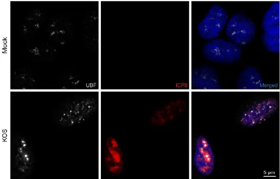 Figure 11 : Relocalisation d’UBF au noyau sous forme de points suite à l’infection. 