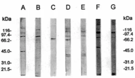 Figure 7:  Immunobuvardage  d'extrait  nucléaire  de  cerveau  d'embryons  de  poulet  avec  les anticorps anti-RTa commun, a2,  Pl 