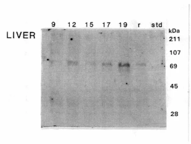 Figure 8:  Immunobuvardage  d'extrait  hépatique  d'embryons  de  poulet  et  de  rat  avec  l'anticorps anti-RTPl  9  12  15  17  19  LIVER  •  r  std  ~  kDa  211  107  69  45  28 