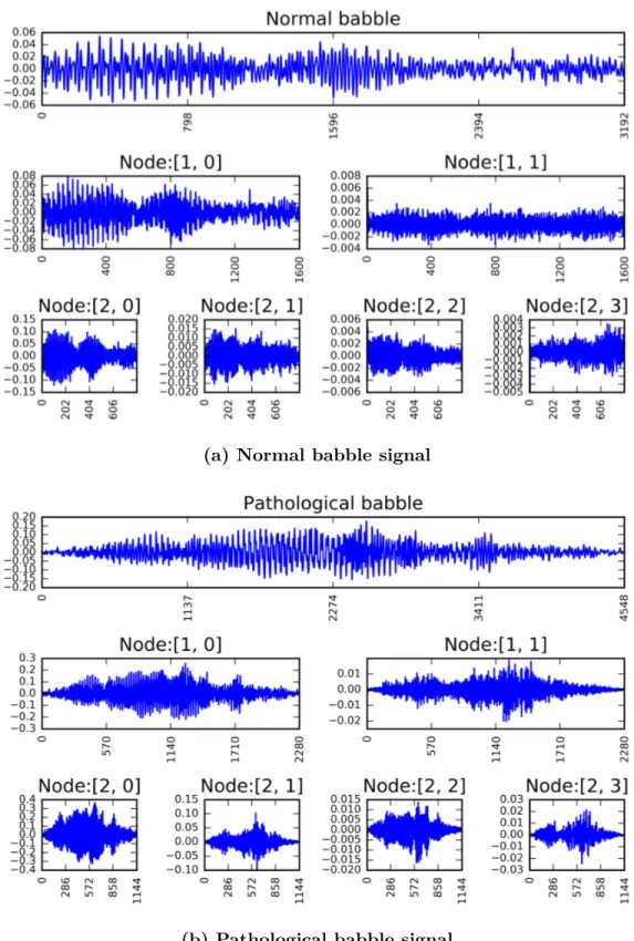 Figure 2.1 – Two-level wavelet packet decomposition of (a) control and (b) ASD babble signals with ‘bior2.6’ mother wavelet
