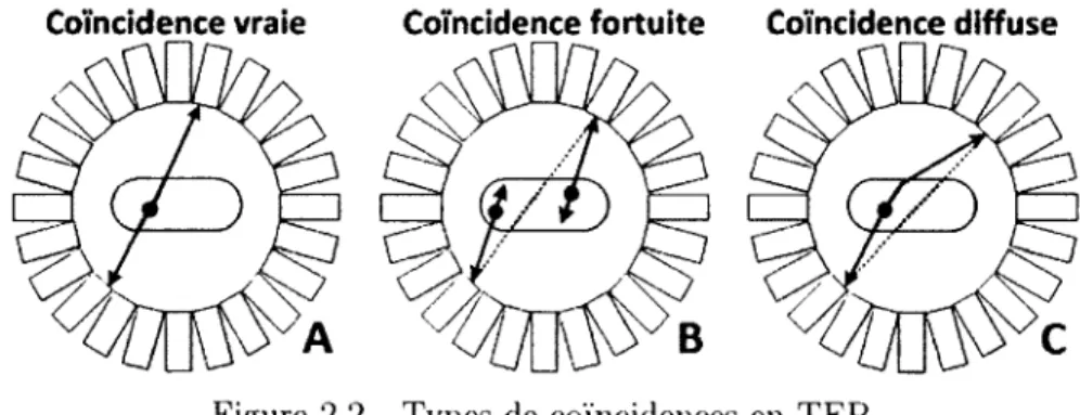 Figure  2.2  Types  de  coïncidences  en  TEP.