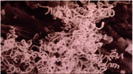 Figure 1: Actinomycètes filamenteuses 