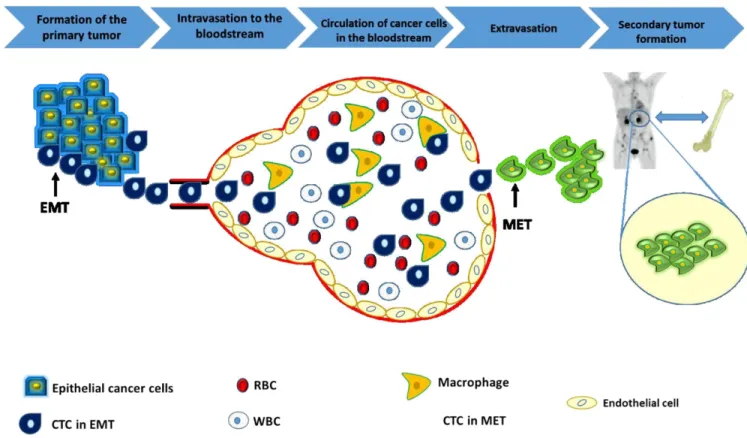 Figure 1.1: Metastasis cascade: In the first stage, which includes the formation of the primary tumor, cancer cells start to  invade a local epithelial tissue and divide there