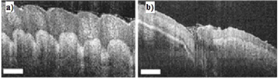 Figure  3.3 :  Coupe  en  profondeur  d’un  doigt  acquise  par  SD-OCT :  a)  empreintes  digitales ;  b)  ongle (reproduit de Iftimia et al [54] avec la permission de AIP Publishing)