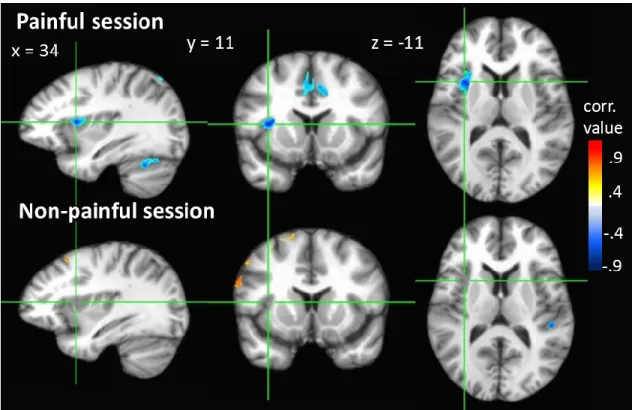 Figure  4.  Voxel-wise  p-values  between  mnemonic  accuracy  scores  and  functional  brain  activity