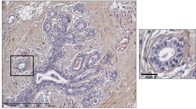 Figure 1.5   Coupe histologique de la glande mammaire normale. À gauche, une coupe histologique d’un canal  qui se termine en plusieurs lobules et qui est entouré d’un stroma fibro-adipeux