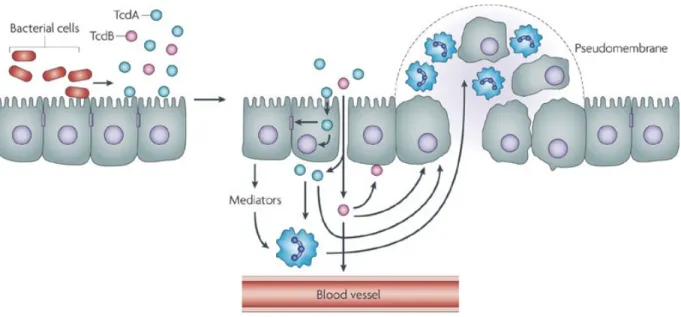 Figure 2. Modèle de la formation des pseudomembranes lors d’infections à C. difficile