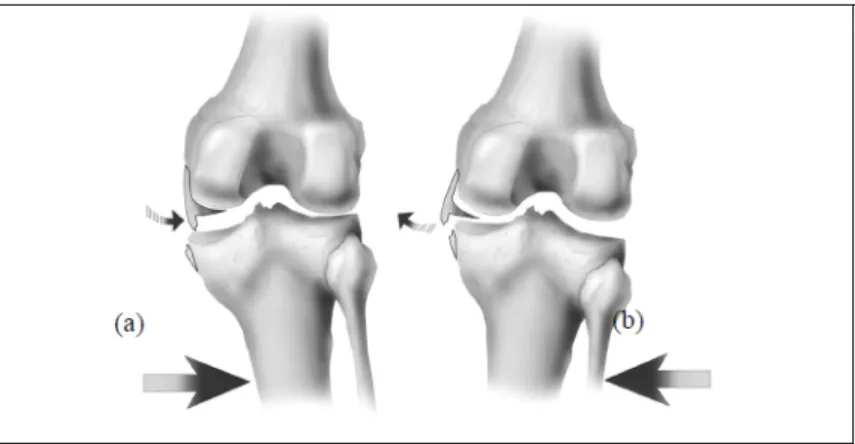 Figure 2.7 – Mouvement d’abduction (a) et d’adduction (b) du genou droit [28]