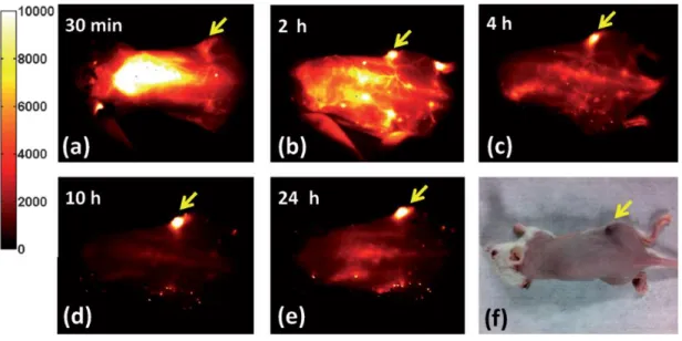 Figure  1.6  NIR-II  fluorescence  imaging  of  a  xenograft  tumor  with  high  uptake  of  Ag 2 S  QDs