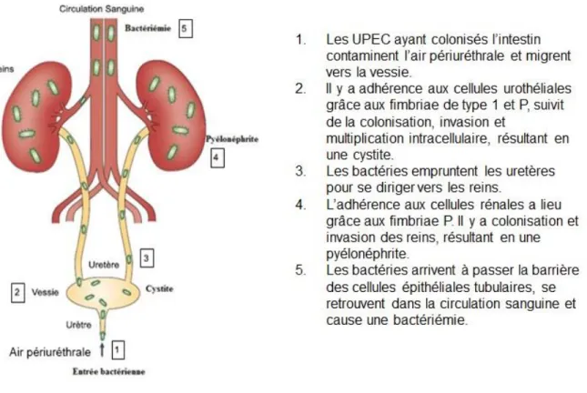 Figure 2 : Les différentes étapes d’une infection du tractus urinaire.  