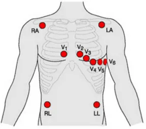 Figure 2.3 – Ten-electrode location for the 12-lead standard ECG configuration.