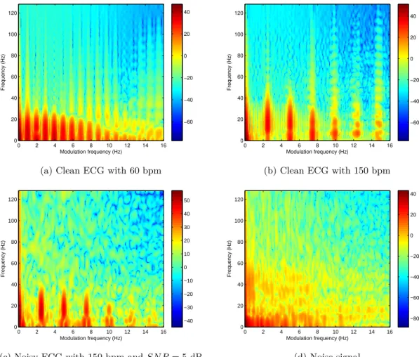 Figure 2.9 – Modulation spectrograms of synthesized clean ECGs with (a) 60 and (b) 150 bpm, (c) noisy ECG with an SN R = 5 dB (150 bpm), and (d) noise signal with recorded muscle contraction and electrode movement.