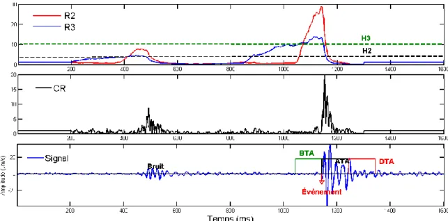 Figure  2.4.  La  technique  ATA/BTA/DTA  appliquée  sur  un  signal  de  longueur  1600  échantillons ; Fs=1000 Hz, BTA=ATA=DTA=50ms