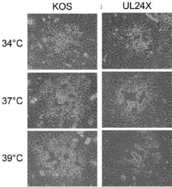 Figure 9 : Phénotype des virus KOS et UL24X en culture cellulaire. L‟analyse de la morphologie des  plages au microscope électronique, a été réalisée 2 jours post-infection de cellules Vero incubées à 34,  37 ou 39°C