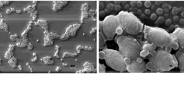Figure 3- S. unisporus cells through SEM (scanning electron microscopy): A) Colony  formation of S