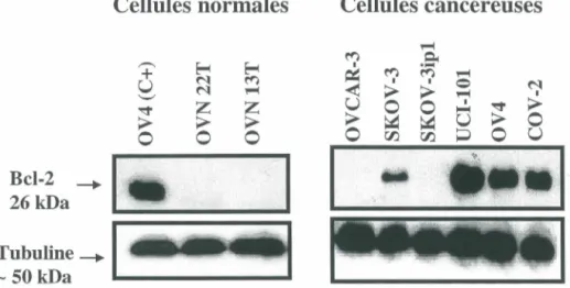Figure 6.  Expression  de  la  protéine  Bcl-2  et  sensibilité  au  cisplatin  de  cellules  ovariennes normales et cancéreuses 