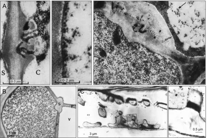 Figure 11. Plant virus particles are associated with vascular conducting tubes. 