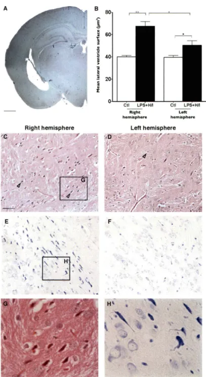 Figure  3.  Histological  analysis  of LPS+H/1-exposed  brain.  The  coronal  brain  section  showed an  enlarged right lateral ventricle, ipsilateral to  ischemia (A)