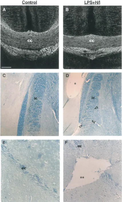 Figure 4.  Histological  analysis  of brain  exposed  to  LPS+H/I as  compared  to  control