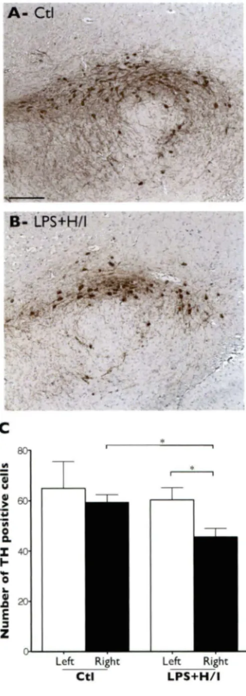 Figure  7.  Immunocytochemical  analysis  of  dopaminergic  neurons  in  the  substantia  nigra