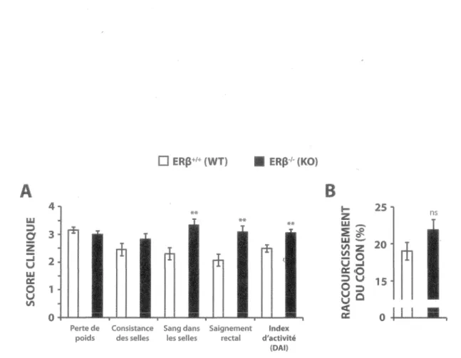 Figure 7 - La perte d'ERP augmente les signes cliniques de colite dans le modèle  murin induit au DSS