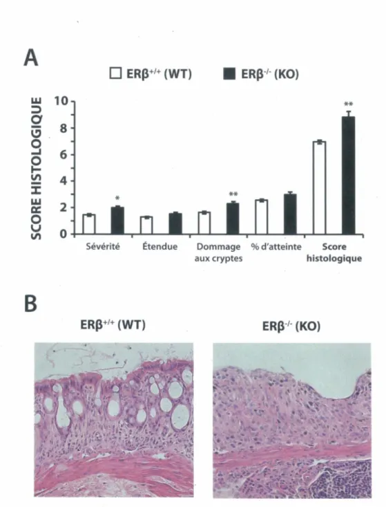 Figure  8  - La  perte  d'ER(J  augmente  les  signes  histologiques  d'inflammation  dans le modèle murin de colite induite au DSS