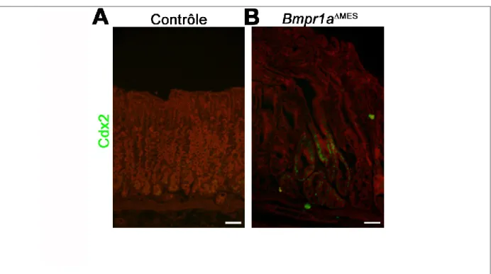 Figure  25.  Certaines  glandes  des  souris  Bmpr1a MES   présentent  un marquage  positif  pour Cdx2 signe de métaplasie intestinale à P180 
