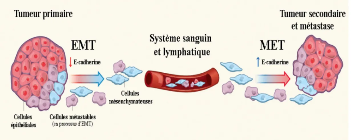 Figure 10- Implication de l’EMT dans l’invasion et la formation de métastases  Rôle de la transition épithélio-mésenchymateuse (EMT) dans la progression du cancer