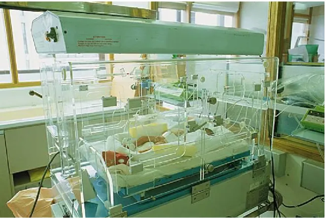 Figure 7 : Monitoring des nouveau-nés. Nouveau-né placé en incubateur pour maintenir  la température, administrer les traitements (ictère), surveiller le cœur fœtal et la saturation  en O2 (http://www.lookfordiagnosis.com/) 